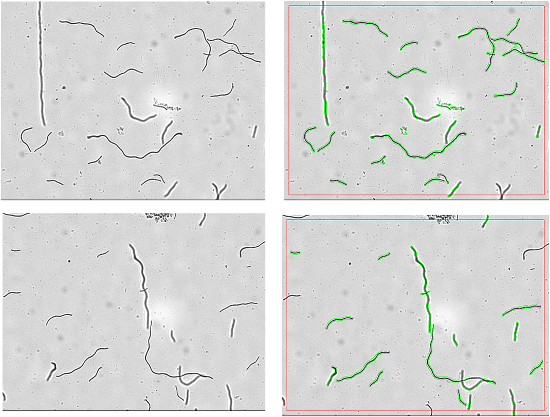 X2-Algae filamentous BF counting.png